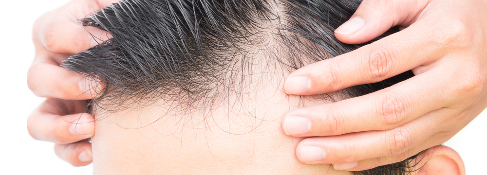 Saç Ekimi Beyne Zarar Verir Mi?